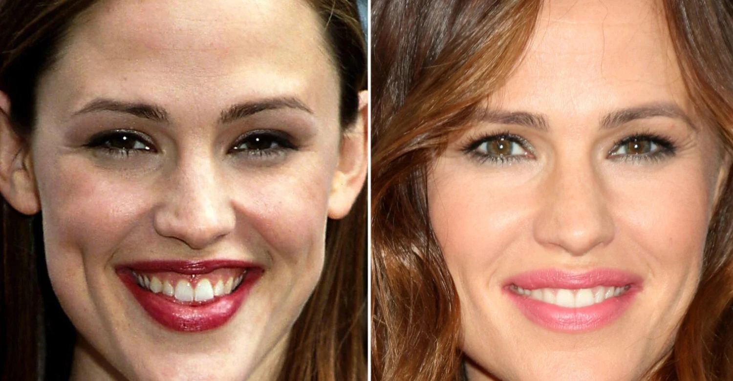 Jennifer Garner